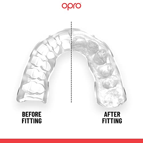 OPRO Instant Custom-Fit Mouth Guard, Dentist Mouthguard, Revolutionary Fitting Technology for Ultimate Comfort, Protection & Fit, Gum Shield for Rugby, Boxing, Hockey, MMA (Black, Adult)